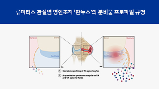 김완욱, 유승아 교수 연구팀, 난치성 류마티스 관절염 진단 및 치료법 새길 열어